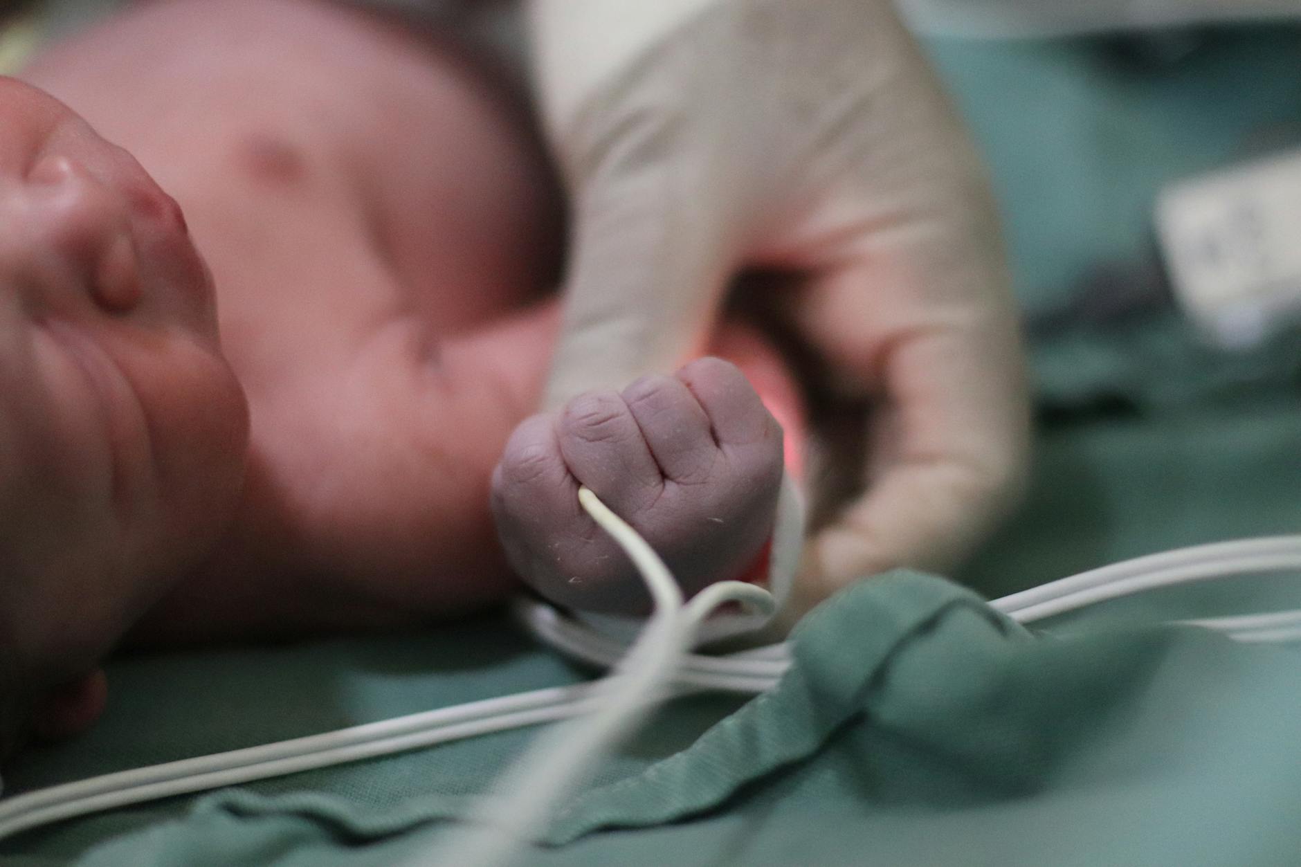Having a Baby Delivered by Emergency Cesarean